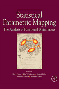Statistical Parametric Mapping the Analysis of Functional Brain Images