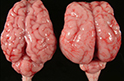 Найден новый ген, связанный с развитием «гладкого мозга»