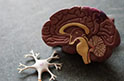 Воспаление мозга при заражении вирусом простого герпеса вызывают сами мозговые клетки