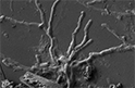 Вулкан на службе нейронаук: обнаружены 2000-летние нейроны человеческого мозга